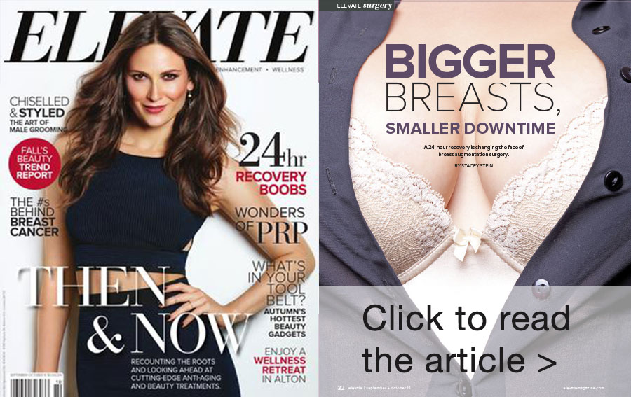Beautiful woman with large breasts after breast augmentation.